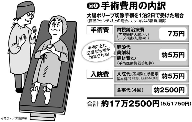 手術費用の内訳（大腸ポリープ切除手術を1泊2日で受けた場合）