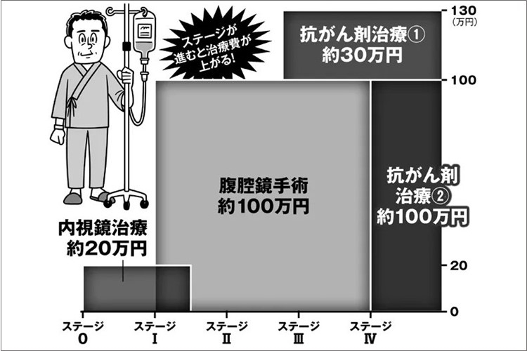 医療費高いがん手術　「保険適用外」を選ぶメリット・デメリット