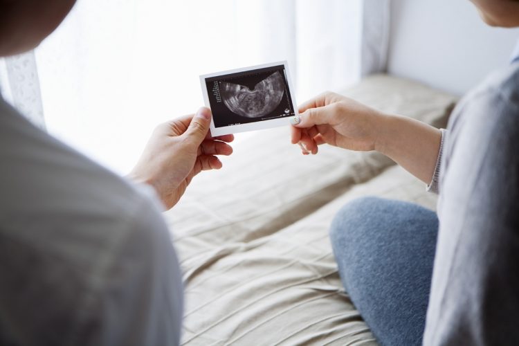 アメリカで卵子提供を受ける選択をするのは、どのような人が多いのか（イメージ。Getty Images）