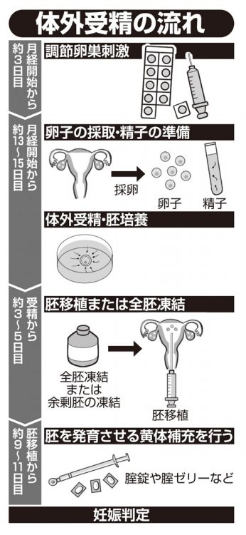 体外受精の流れ