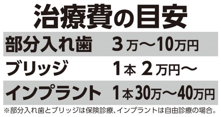 治療費の目安（部分入れ歯とブリッジは保険診察、インプラントは自由診療の場合）