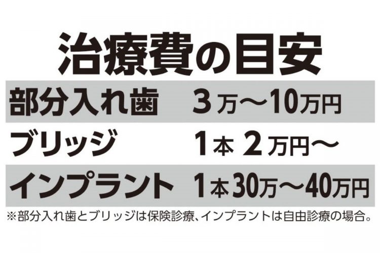 治療費の目安（部分入れ歯とブリッジは保険診察、インプラントは自由診療の場合）