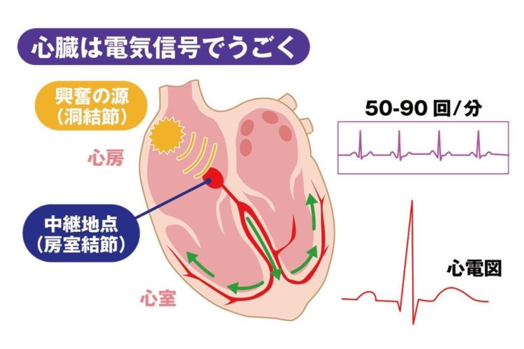 心臓は拍動するために規則的に電気刺激を作り出している。電気信号を出しているのは、右心房にある洞房結節