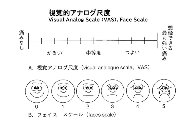 痛みを客観的に評価するための検査で使われるVAS