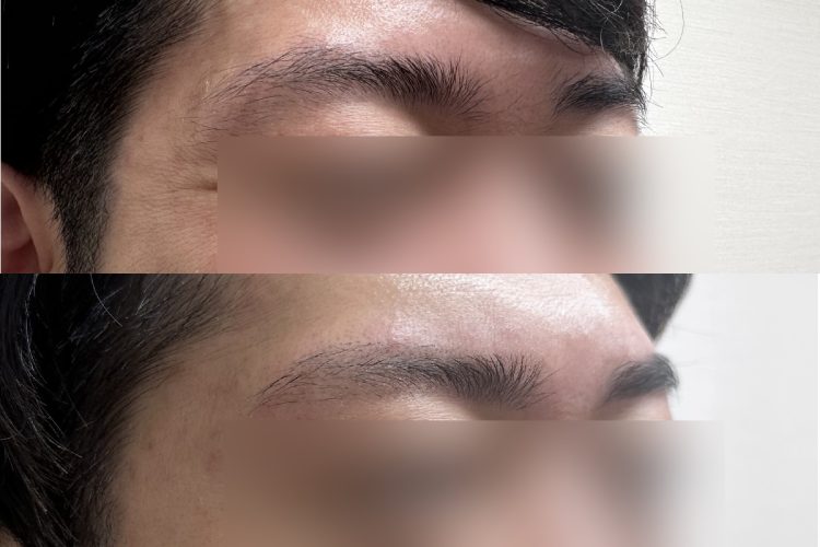 斜めから見ると、変化がはっきりわかる