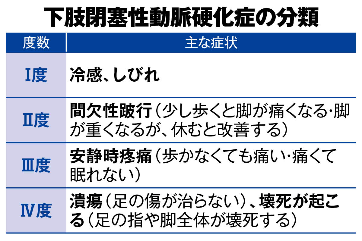 下肢閉塞性動脈硬化症（ASO）は症状に応じて5段階に分類される