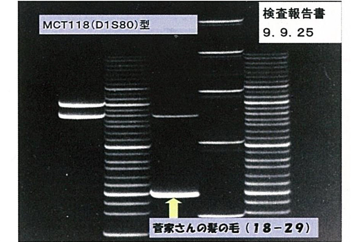 押田茂實・日本大学名誉教授が再鑑定を行なった、菅家さんのDNA型鑑定(MCT118法)。菅家さんのDNA型は科警研が判定した犯人の「18-30型」ではなく、「18-29型」であることが判明した(押田氏提供)