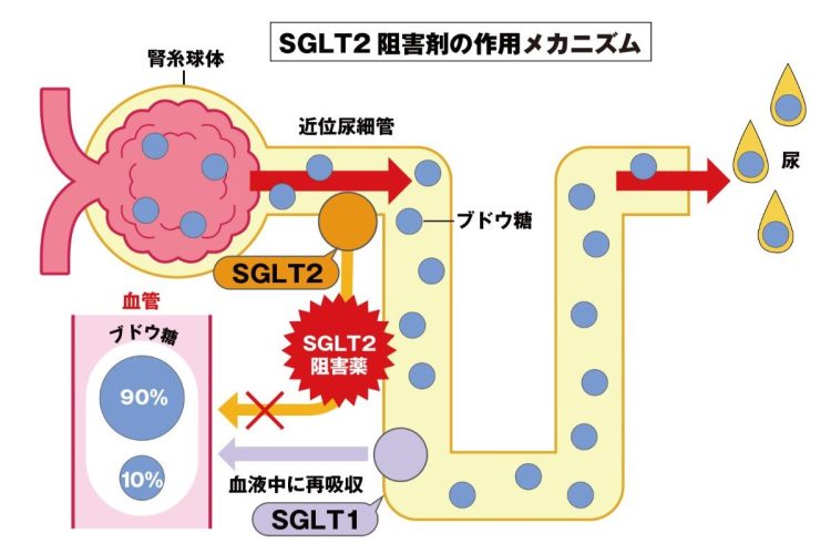 SGLT2阻害薬は2014年に保険承認された