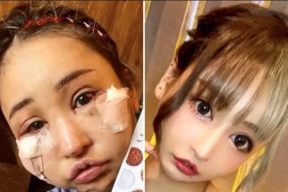 ドラマ『ダウンタイム』より怖い美容整形医療の現実　問題視される施術を行う医師、生涯付き合うしかない後遺症、男性の施術にも数々のリスク…現役医師と施術失敗患者が告白