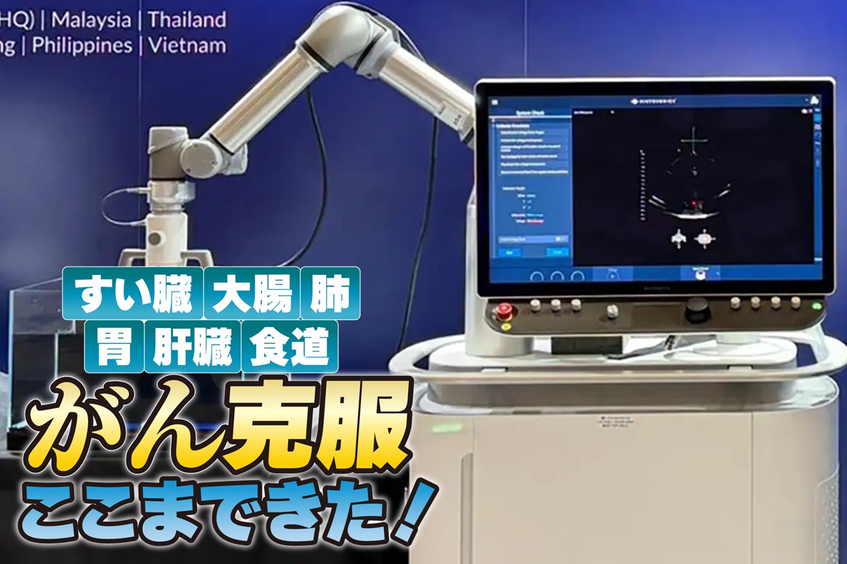 薬でも手術でもない超音波を使った治療法「ヒストトリプシー」